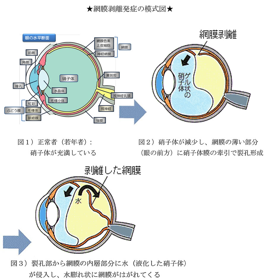 黒い 生理 終わり かけ